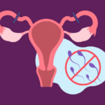 Beyond Birth Control: The Surprising Long-Term Health Benefits of Tubectomy