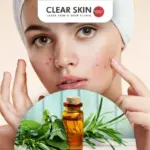 Clear Skin in a Bottle: How to Use Tea Tree Oil to Fight Stubborn Acne