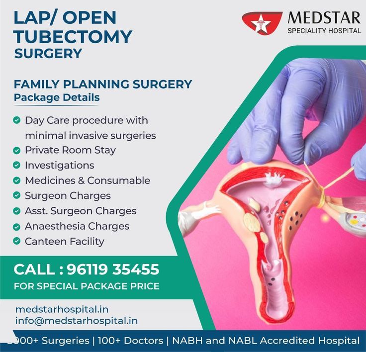 Is a Tubectomy Right for You? Exploring the Health and Lifestyle Pros
