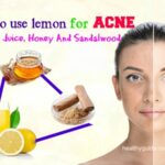 The Clear Skin Secret Unveiled: Can Lemon Juice Really Help Fight Acne?