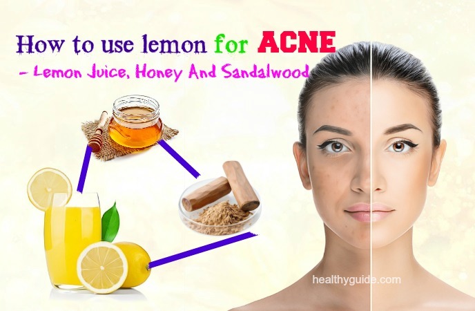 The Clear Skin Secret Unveiled: Can Lemon Juice Really Help Fight Acne?